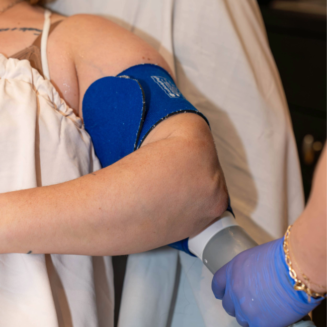Provider applying CoolSculpting targeted applicator to patient for precise fat reduction at Gold Skin Care Nashville
