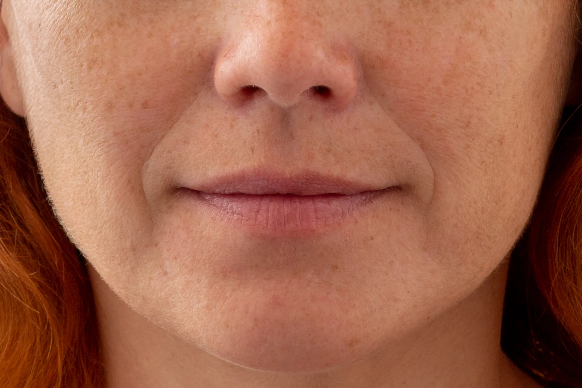 Close-up of lips showing natural enhancement after dermal filler treatment at Gold Skin Care Nashville